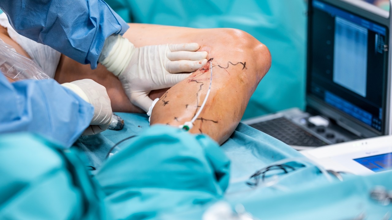 Vascular Surgery at Greenview Medical Center