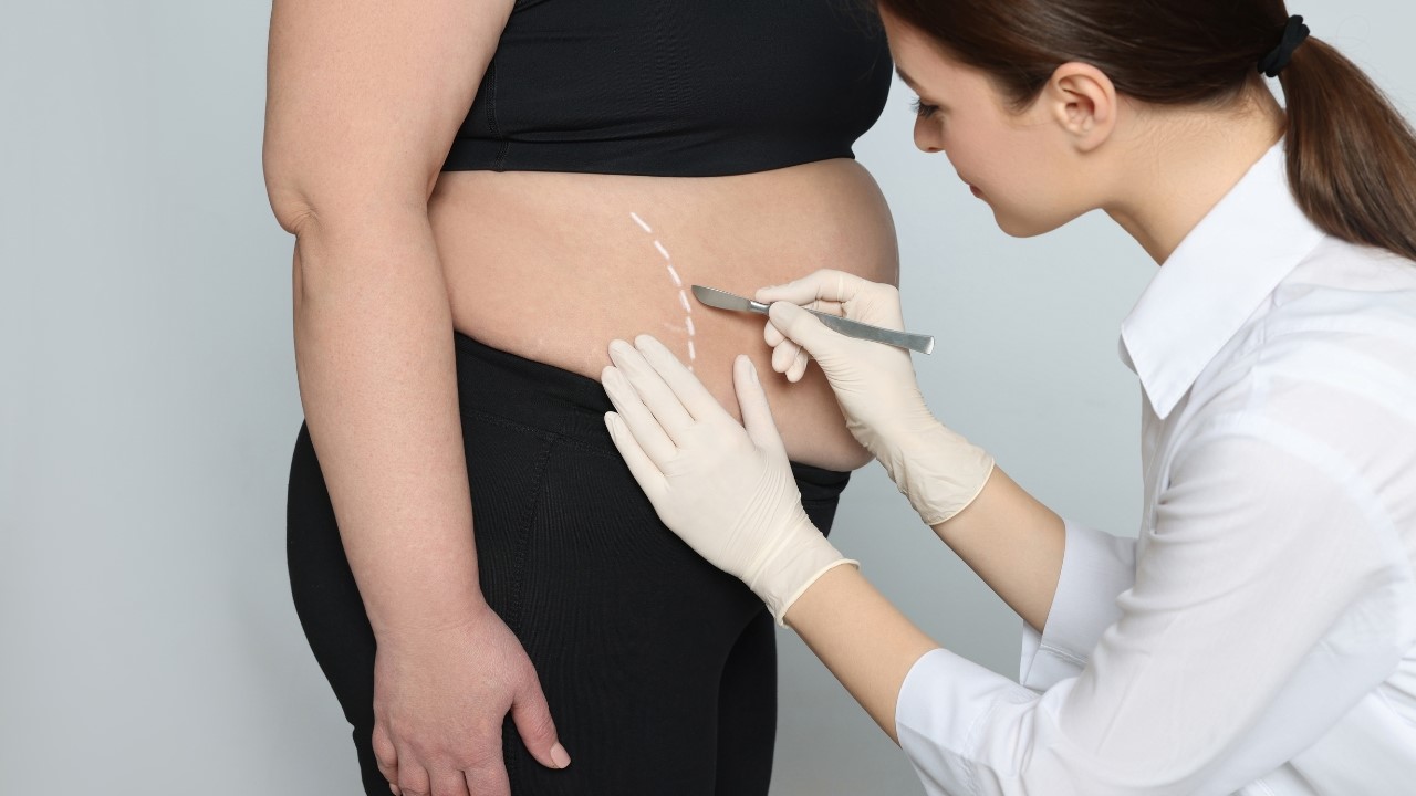 Bariatric & Metabolic Surgery at Greenview Medical Center
